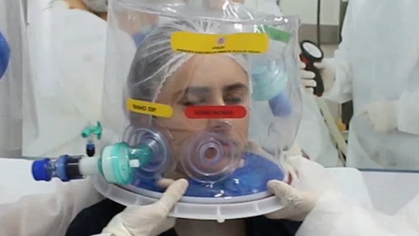Casco de respiración artificial reduce intubación en un 60%